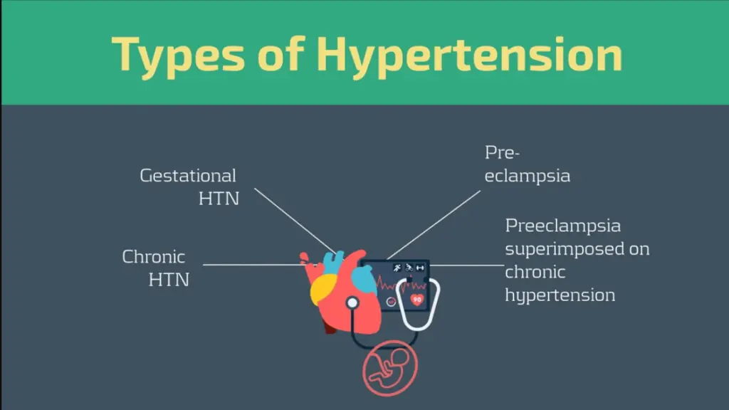 Chronic Hypertension Essential Guide For Chronic Disease Management