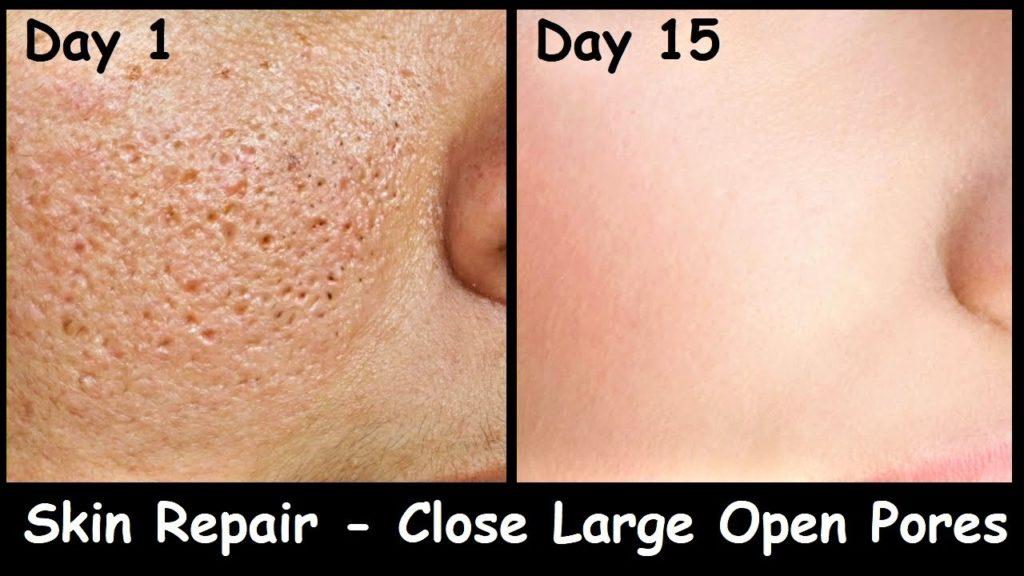 Enjoy Even Tone by Eliminating Visible Skin Pores