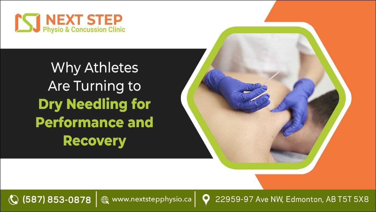 Why Athletes Are Turning to Dry Needling for Performance and Recovery